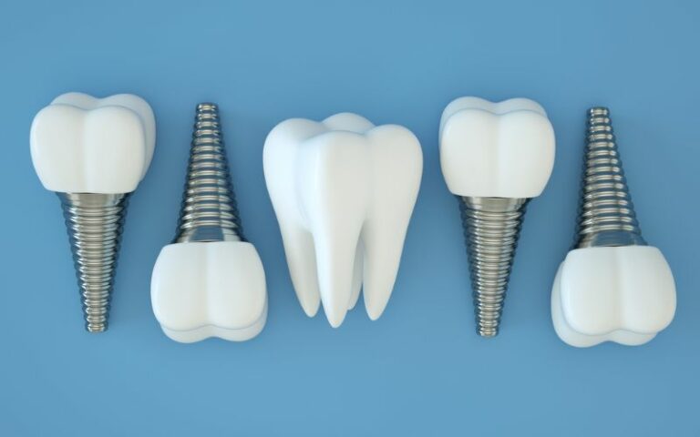 fake dental implants laid on alternating sides with a fake tooth in the middle