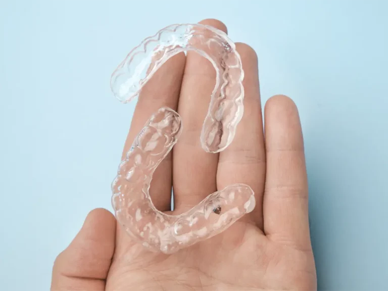 Dental Retainers in Selah, WA at Selah Creek Dental