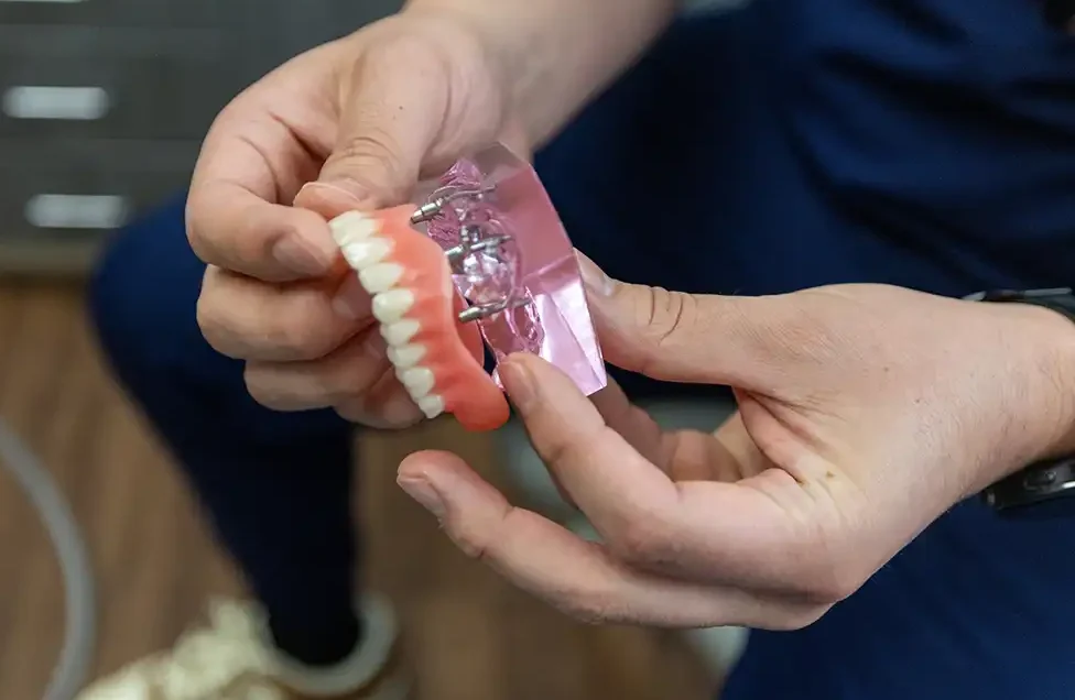 Full-Mouth Dental Implants
