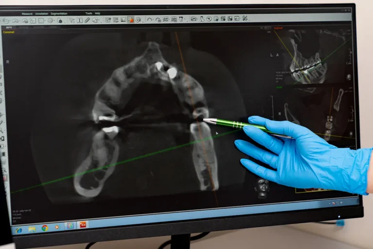 3D-Guided Dental Surgery in Selah, WA at Selah Creek Dental